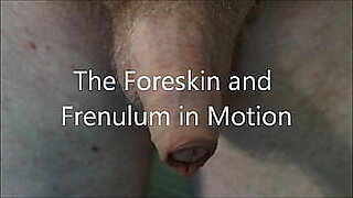 foreskin hood